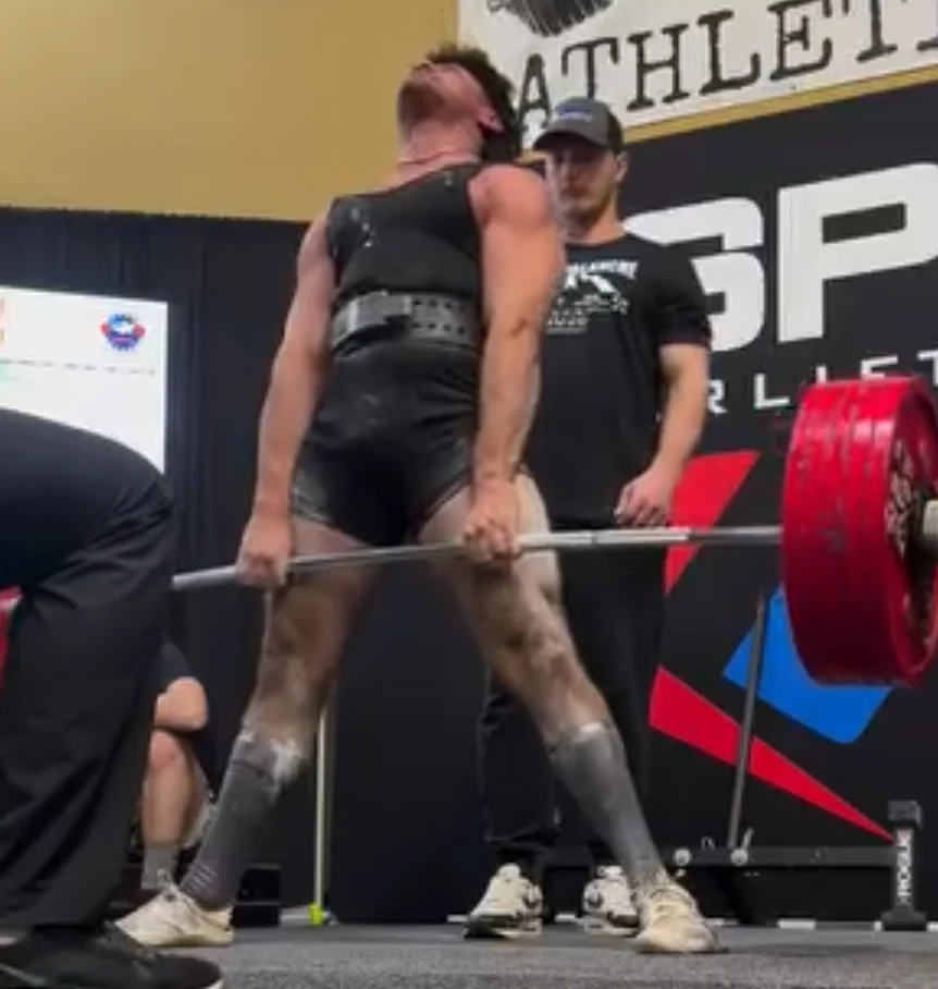 Low Back Pain Powerlifting Rehab